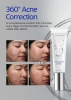 ZO Skin Health Retinol+Blemish Complex Serum redukujące trądzik 50 ml