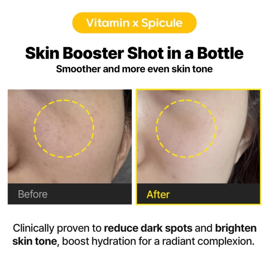 Cell Fusion C 15% Vita Shot Ampoule Rozjaśniające serum z 15% witaminą C i mikroigłami 20 g