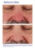 ZO Skin Health Rozatrol Kuracja dla zaczerwienionej, uwrażliwionej skóry 20 ml