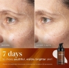 Medik8 C-Tetra Advanced Silne serum żelowe z witaminą C 20 % i fitoegzosomami 30 ml