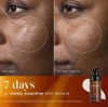 Medik8 C-Tetra Advanced Silne serum żelowe z witaminą C 20 % i fitoegzosomami 30 ml
