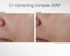 Revision C+ Correcting Complex Serum Odmładzające i korygujące przebarwienia serum 30 ml