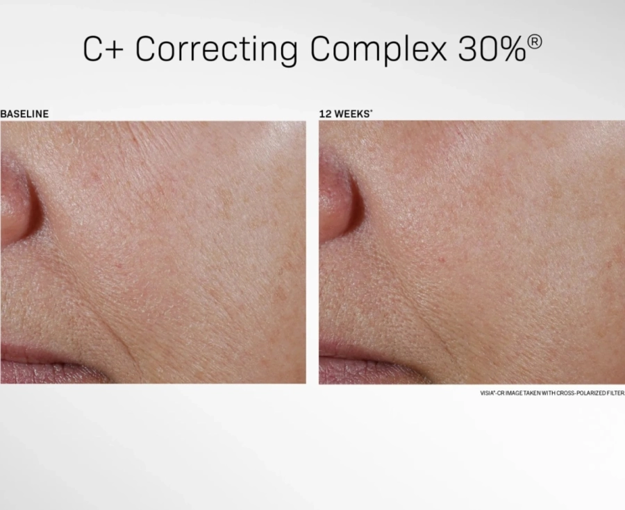 Revision C+ Correcting Complex Serum Odmładzające i korygujące przebarwienia serum 30 ml