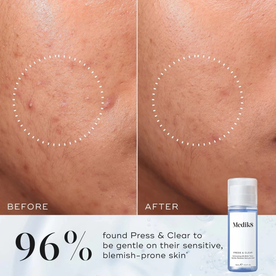 Medik8 Press & Clear Tonik dla skór z niedoskonałościami 150 ml